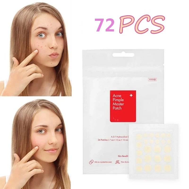 COSRX-Acne Pimple Máster Patch - Korean Glow